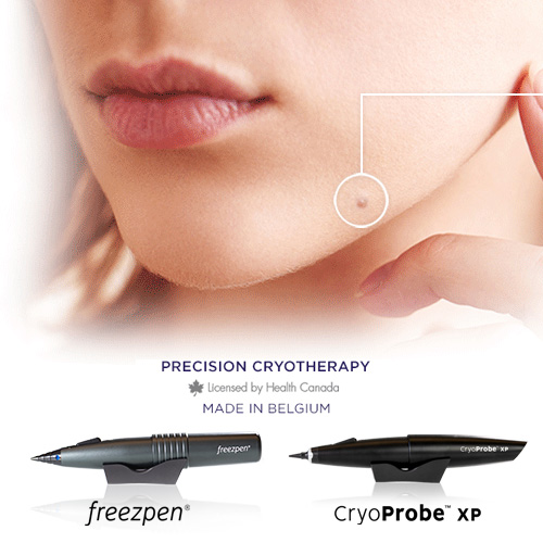 FreezPen & CryoProbe